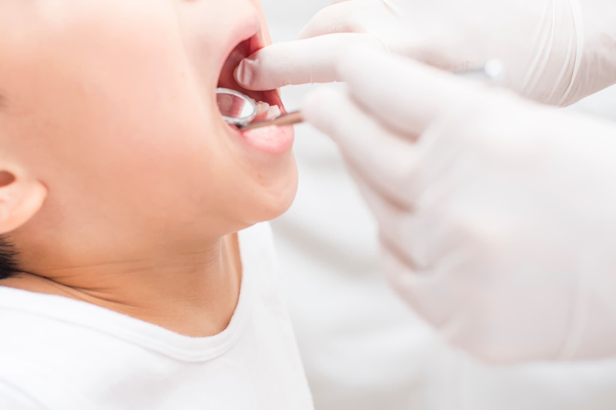 虫歯の治療を受ける子供