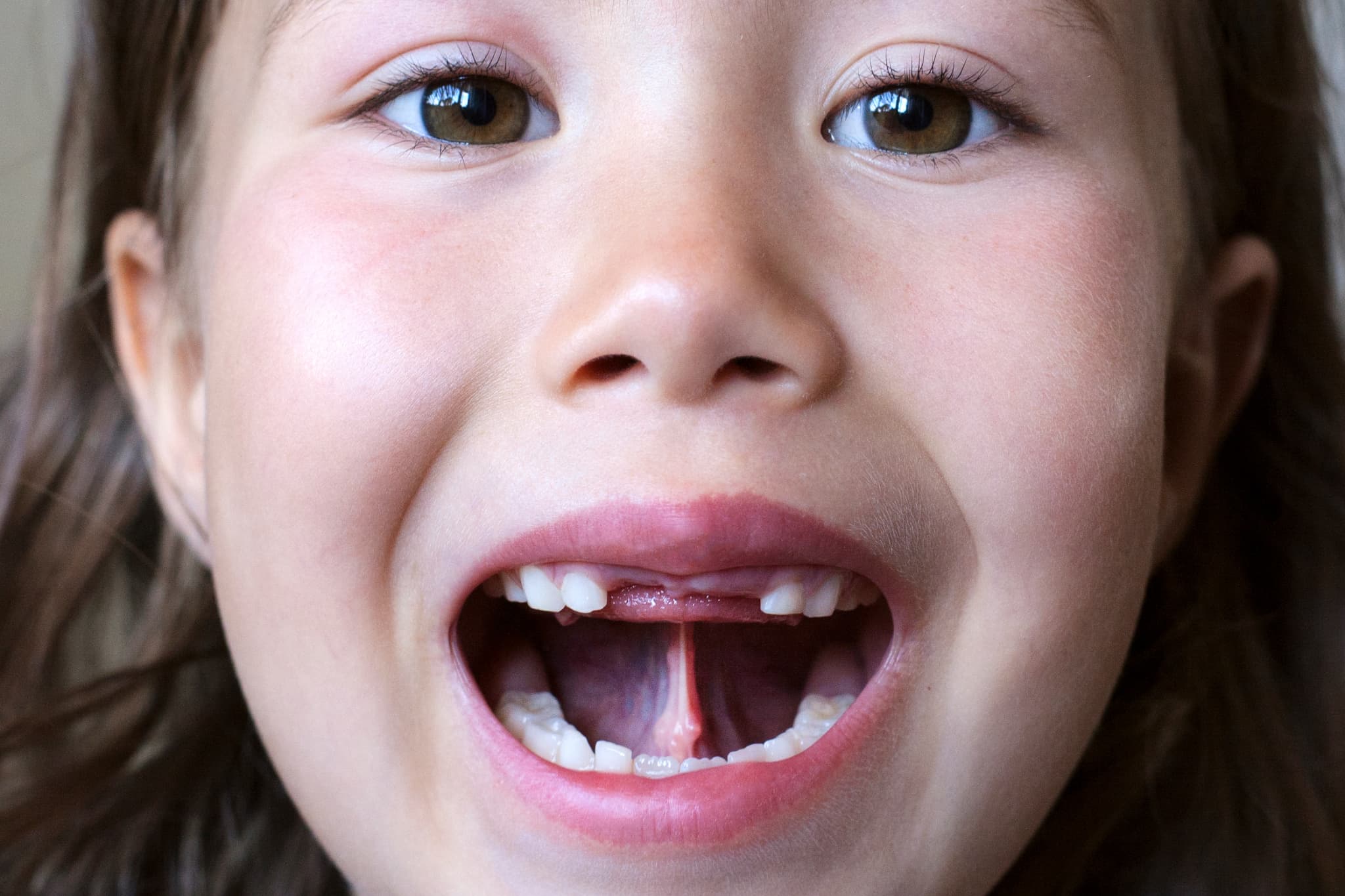 MFTのトレーニングをする女の子