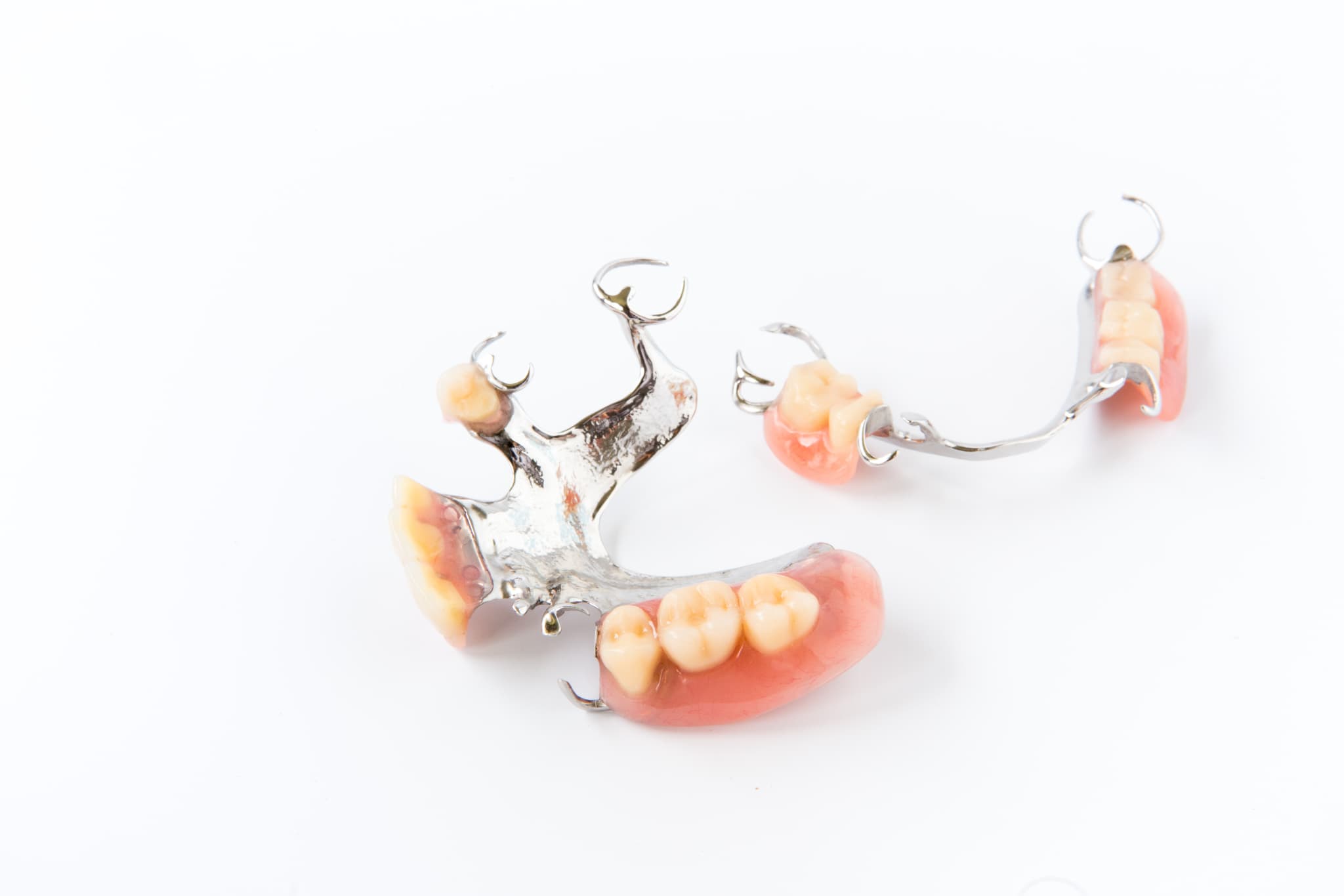 奥歯の部分入れ歯の種類と費用