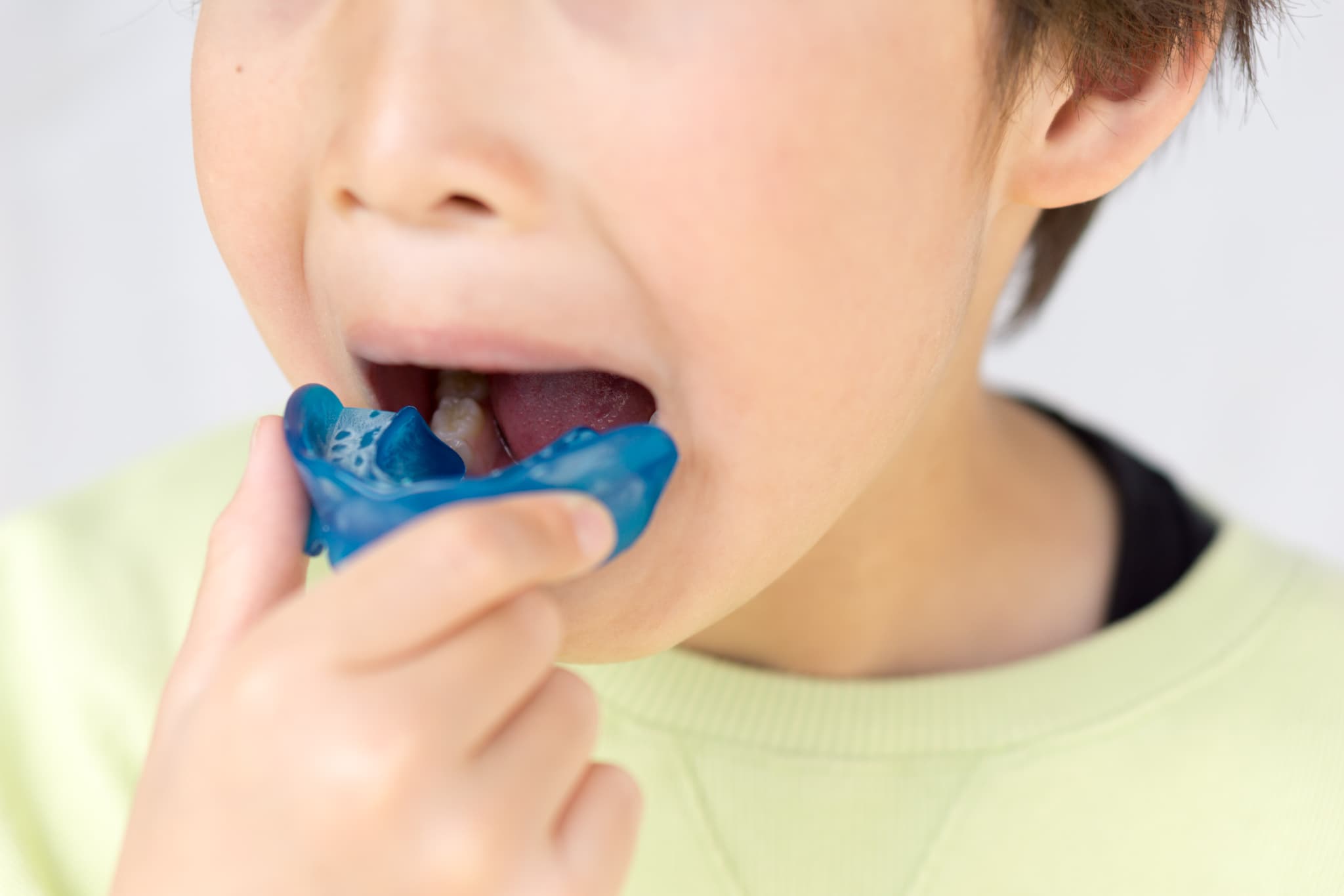 プレオルソで矯正する子ども